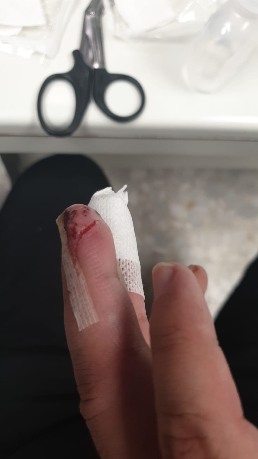 Dedo anular ensangrentado durante la cura, con gasas y unas tijeras de curas al fondo