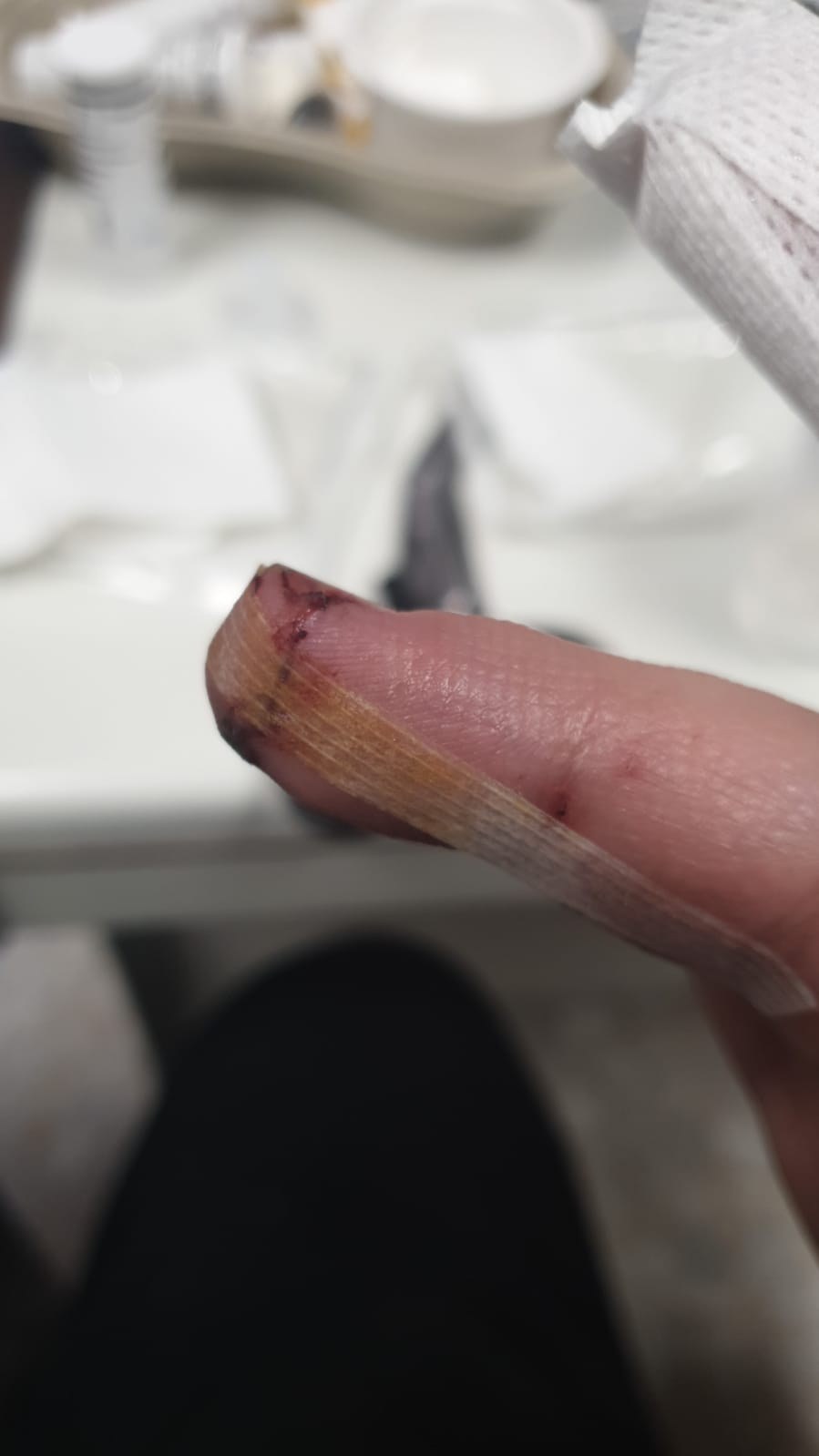Dedo anular ya limpio tras la cura, con la uña partida, la herida de la yema visible y esparadrapo de papel