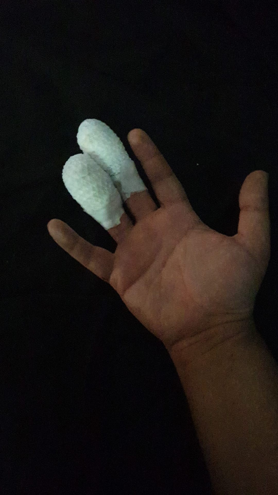 La misma mano vendada esa noche en casa, con los dos dedos cubiertos