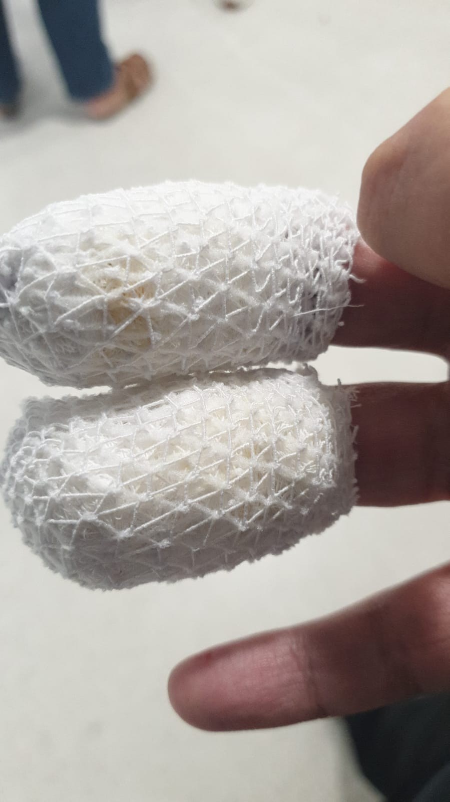 Dos dedos vendados con malla elástica blanca tras la cura en la clínica